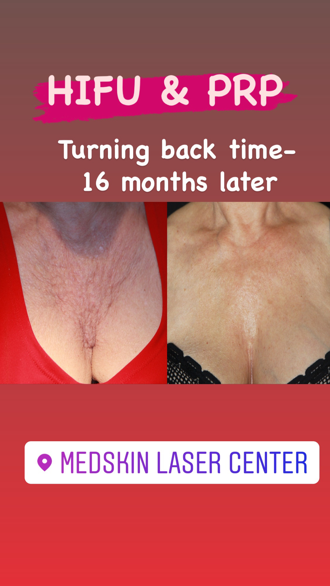 Anti aging treatments are so - MedSkin Laser Center